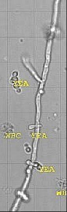 sedimax levures leucocytes