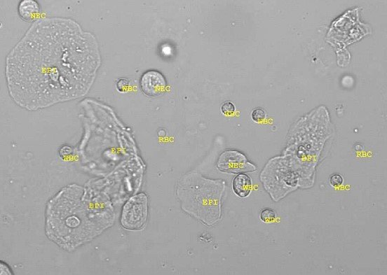 sedimax cellules épithéliales