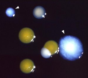 colonie legionella pneumophila