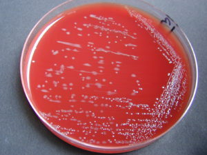 coproculture Campylobacter gélose sang
