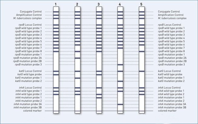 Genotype MTBDR