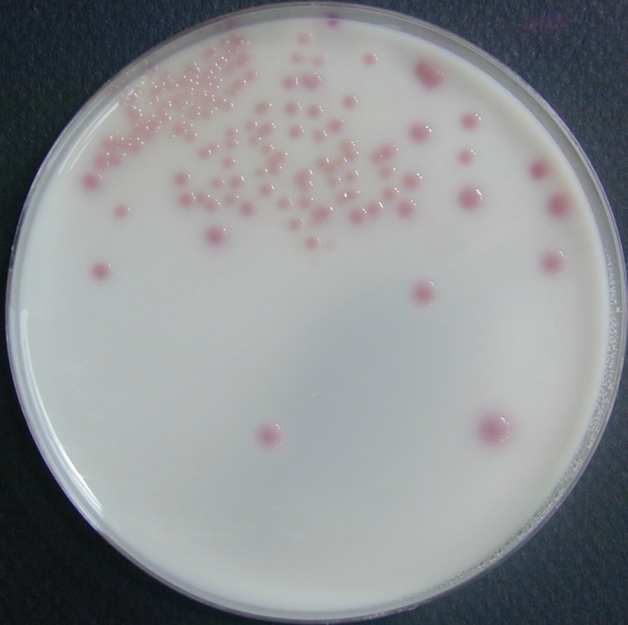uriselect 4 Escherichia coli