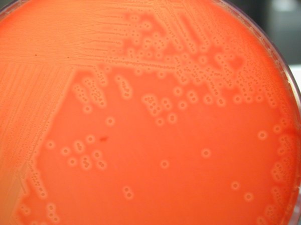 listeria monoctyogenes gélose sang