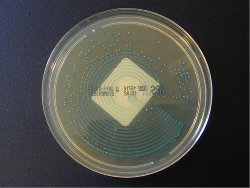 ecbu enterococcus ensemenceur Previ Isola