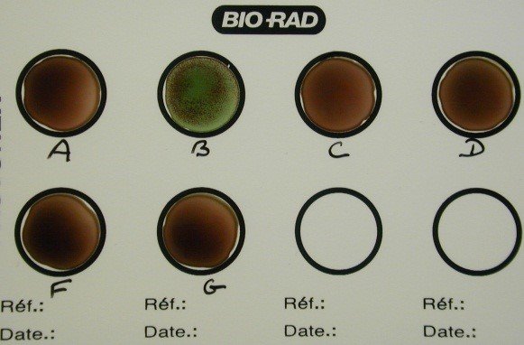 groupage streptococcus agalactiae