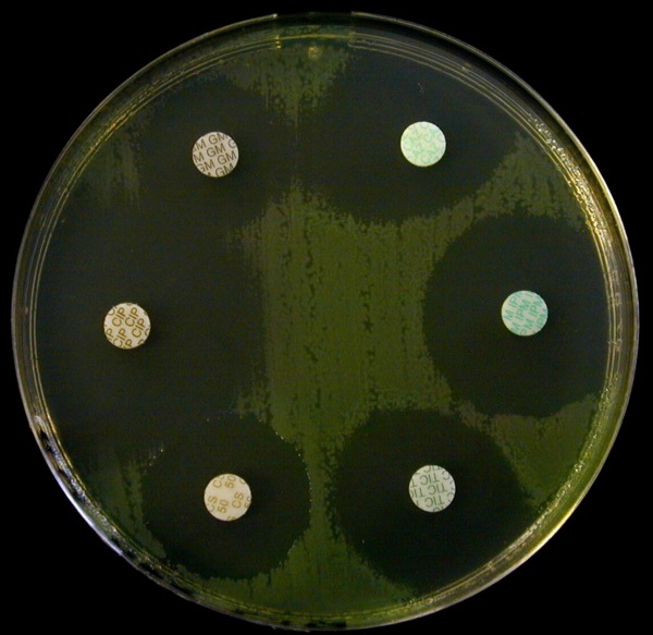 antibiogramme Pseudomonas aeruginosa