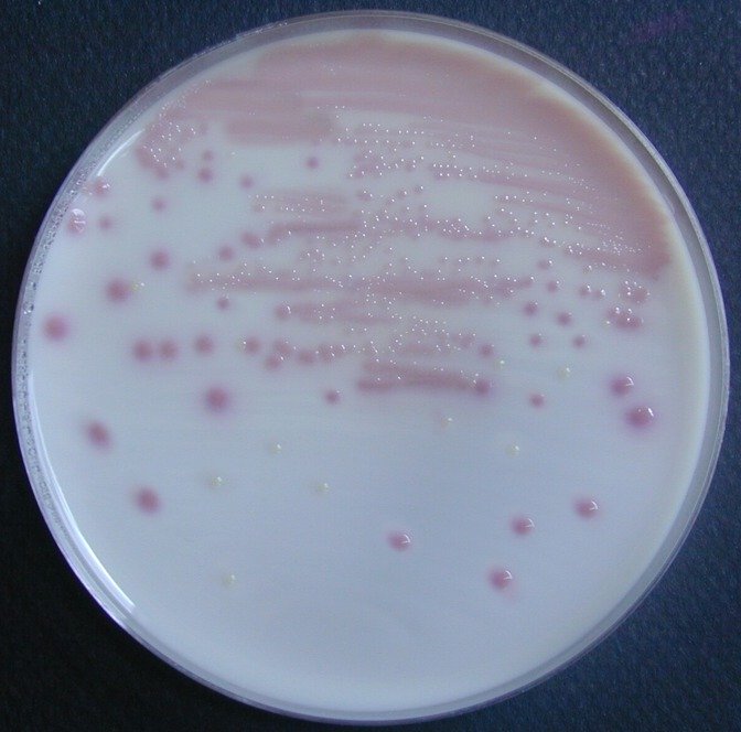 Uriselect4 Escherichia coli Pseudomonas aeruginosa