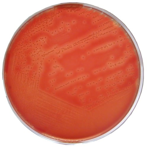 Arcanobacterium haemolyticum