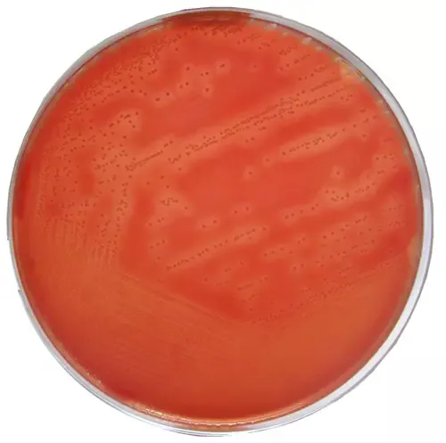 Arcanobacterium haemolyticum