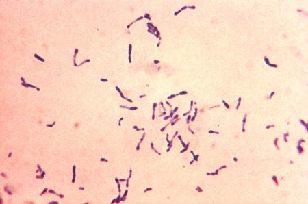 Gram corynebacterium diphtheriae