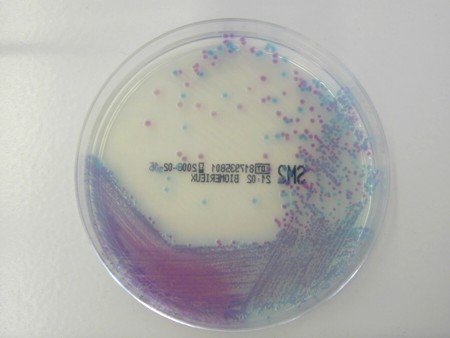 SM2 Salmonella Eschericia coli