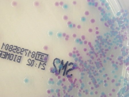 SM2 Salmonella Eschericia coli