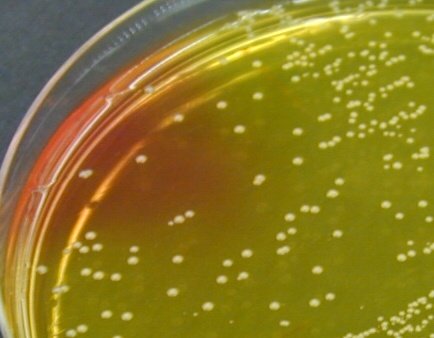 culture de staphylococcus aureus chapman
