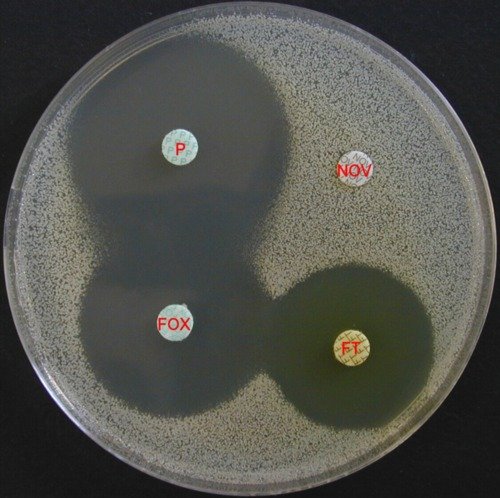 staphylococcus saprophyticus