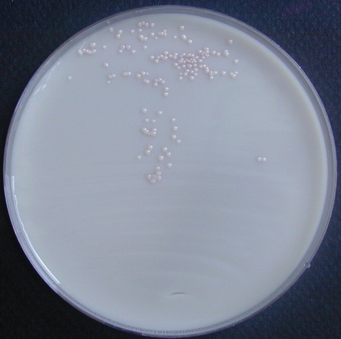 Uriselect 4 Staphylococcus saprophyticus