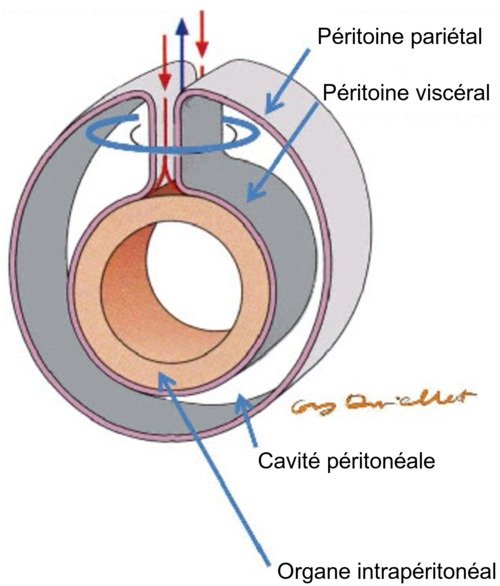 cavite peritoneale