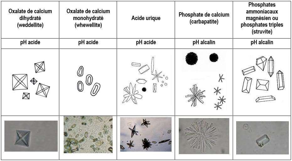 Presence De Cristaux Oxalate De Calcium Dans Les Urines ECBU : Examen cytobactériologique des urines - y a t-il infection