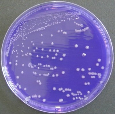 BCP Salmonella enteritidis