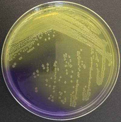 BCP Escherichia coli