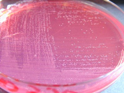 Chapman Staphylococcus epidermidis