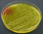 Staphylococcus aureus Chapman