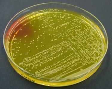 Chapman Staphylococcus aureus