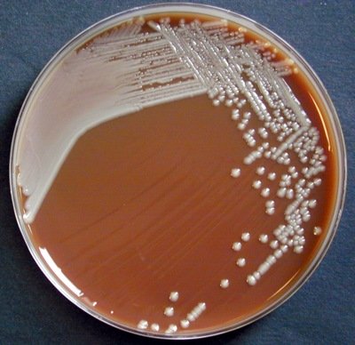 Chocolat Enterobacter aerogenes