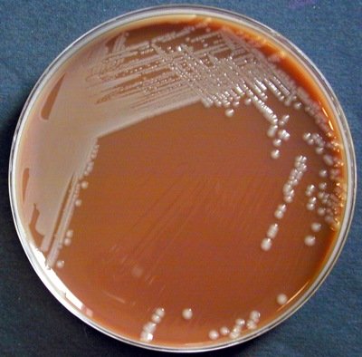 Chocolat Escherichia coli