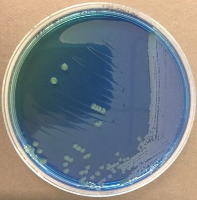 Drigalski Escherichia coli lactose négatif