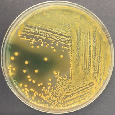 Drigalski Escherichia coli