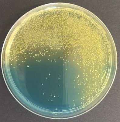 Staphylococcus saprophyticus CLED