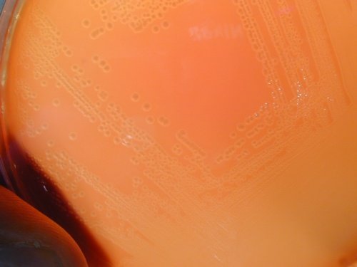 Gelose au sang Streptocoque B