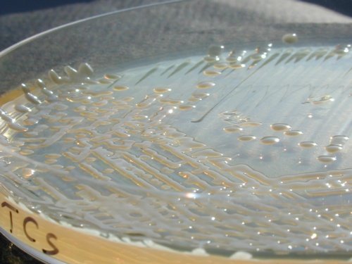 TCS Klebsiella muqueuse