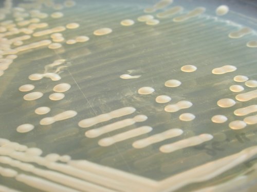 TCS Klebsiella muqueuse