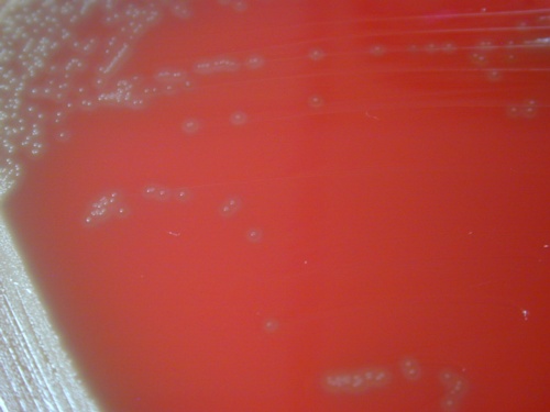 gelose au sang Streptococcus pneumoniae