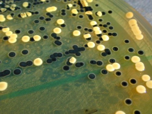 Hektoen Salmonella Escherichia coli