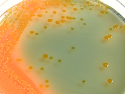Hektoen Shigella Escherichia coli