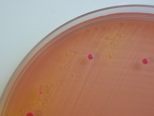 SS avec Shigella et Escherichia coli