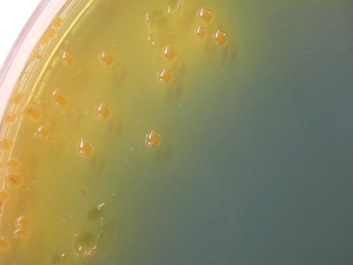 TCBS Vibrio cholerae