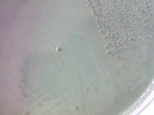 TCBS Vibrio parahaemolyticus
