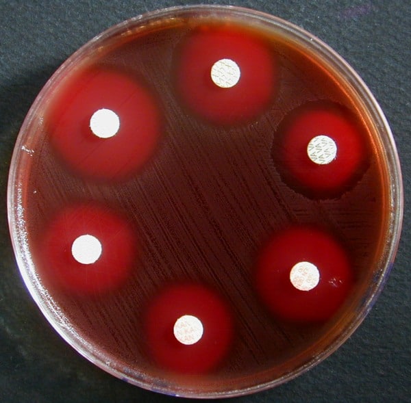 Antibiogramme Streptococcus G