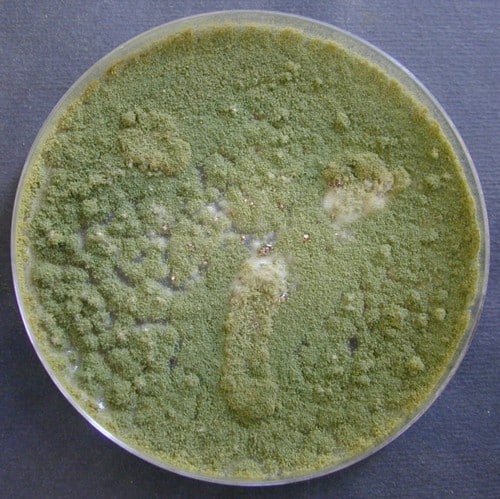 Aspergillus flavus Sabouraud