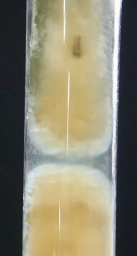 Aspergillus flavus Sabouraud
