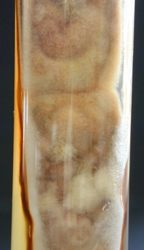 Aspergillus nidulans Sabouraud