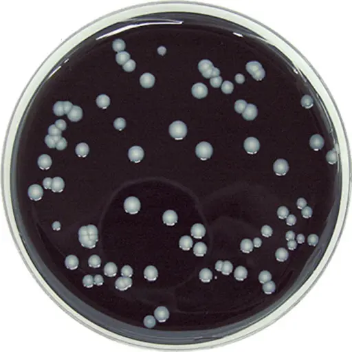 BCYE GVPC Legionella