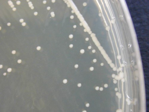 Cryptococcus neoformans Sabouraud