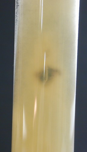 Rhizopus Sabouraud